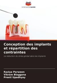 Produktbild: Conception des implants et r&eacute;partition des contraintes