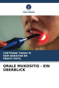 Produktbild: ORALE MUKOSITIS - EIN &Uuml;BERBLICK