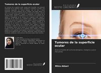 Produktbild: Tumores de la superficie ocular