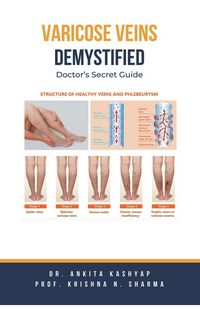 Produktbild: Varicose Veins Demystified