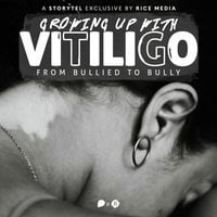 Produktbild: Growing Up With Vitiligo, I Was Bullied&mdash;Until I Became A Bully