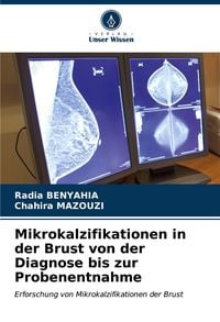 Produktbild: Mikrokalzifikationen in der Brust von der Diagnose bis zur Probenentnahme