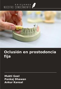 Produktbild: Oclusi&oacute;n en prostodoncia fija
