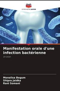 Produktbild: Manifestation orale d'une infection bact&eacute;rienne