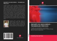 Produktbild: Enfarte Do Mioc&aacute;rdio - Tromb&oacute;lise Precoce