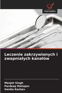 Produktbild: Leczenie zakrzywionych i zwapnia&iquest;ych kana&iquest;&oacute;w