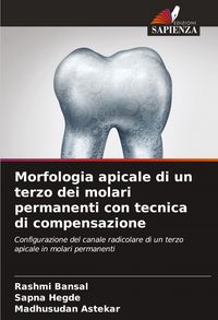 Produktbild: Morfologia apicale di un terzo dei molari permanenti con tecnica di compensazione