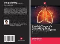 Produktbild: Papel da Tomografia Computorizada no Carcinoma Broncog&eacute;nico