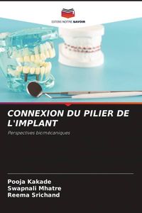 Produktbild: Connexion Du Pilier De L'implant