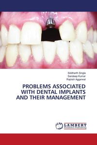 Produktbild: Problems Associated with Dental Implants and Their Management