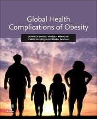 Produktbild: Global Health Complications of Obesity
