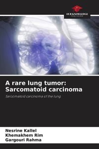 Produktbild: A rare lung tumor: Sarcomatoid carcinoma