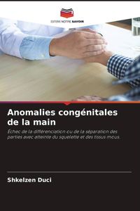 Produktbild: Anomalies cong&eacute;nitales de la main