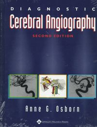 Produktbild: Diagnostic Cerebral Angiography