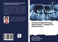 Produktbild: Polnaq reabilitaciq protezami s oporoj na implantaty