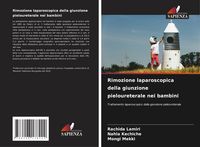 Produktbild: Rimozione laparoscopica della giunzione pieloureterale nei bambini