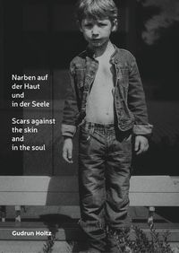 Produktbild: Narben auf der Haut und in der Seele