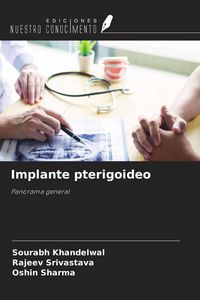 Produktbild: Implante pterigoideo