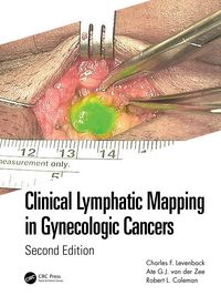 Produktbild: Clinical Lymphatic Mapping in Gynecologic Cancers