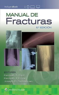 Produktbild: Egol, K: Manual de fracturas