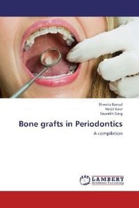 Produktbild: Bansal, S: Bone grafts in Periodontics