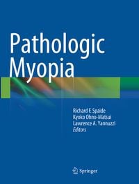 Produktbild: Pathologic Myopia
