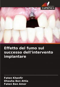 Produktbild: Effetto del fumo sul successo dell'intervento implantare
