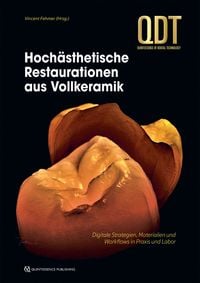 Produktbild: Hoch&auml;sthetische Restaurationen aus Vollkeramik