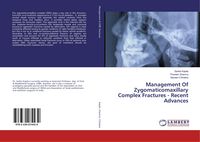 Produktbild: Management Of Zygomaticomaxillary Complex Fractures - Recent Advances