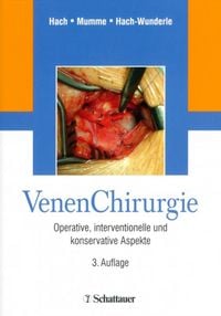 Produktbild: Venen Chirurgie