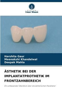 Produktbild: &Auml;sthetik bei der Implantatprothetik im Frontzahnbereich