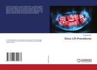 Produktbild: Sinus Lift Procedures