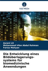 Produktbild: Die Entwicklung eines Bild&uuml;berlagerungs-systems f&uuml;r biomedizinische Anwendungen