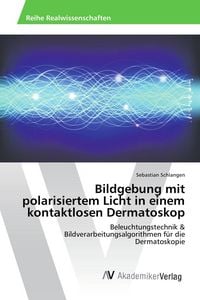 Produktbild: Bildgebung mit polarisiertem Licht in einem kontaktlosen Dermatoskop