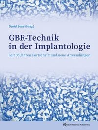 Produktbild: GBR-Technik in der Implantologie