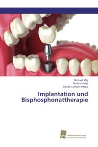 Produktbild: Implantation und Bisphosphonattherapie