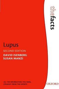 Produktbild: Lupus 2/e