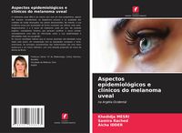 Produktbild: Aspectos epidemiol&oacute;gicos e cl&iacute;nicos do melanoma uveal