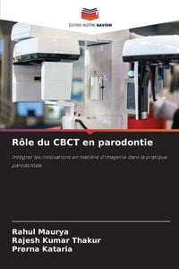 Produktbild: R&ocirc;le du CBCT en parodontie