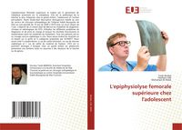 Produktbild: L'epiphysiolyse femorale sup&eacute;rieure chez l'adolescent