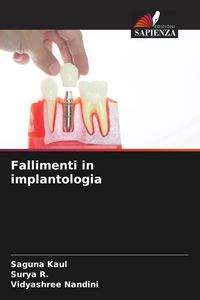 Produktbild: Fallimenti in implantologia