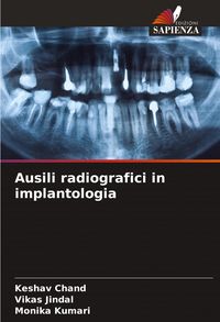 Produktbild: Ausili radiografici in implantologia
