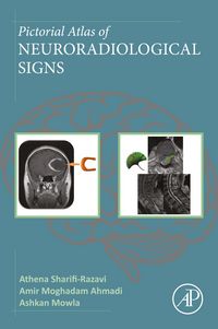 Produktbild: Pictorial Atlas of Neuroradiological Signs