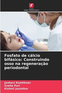 Produktbild: Fosfato de c&aacute;lcio bif&aacute;sico: Construindo osso na regenera&ccedil;&atilde;o periodontal