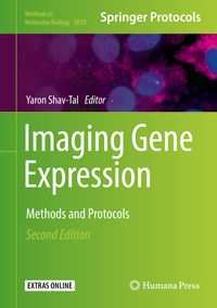 Bild vom Artikel Imaging Gene Expression vom Autor Yaron Shav-Tal