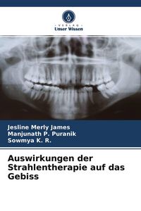 Produktbild: Auswirkungen der Strahlentherapie auf das Gebiss