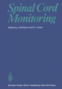 Produktbild: Spinal Cord Monitoring
