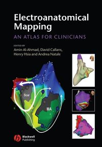 Bild vom Artikel Electroanatomical Mapping vom Autor 