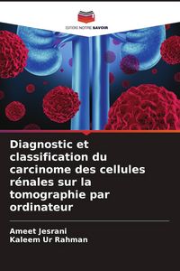 Produktbild: Diagnostic et classification du carcinome des cellules r&eacute;nales sur la tomographie par ordinateur