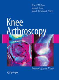 Produktbild: Knee Arthroscopy